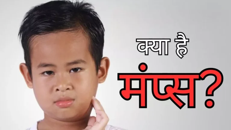 Mumps outbreak in Mumbai: क्या है मंप्स जो मुंबई में बच्चों को तेजी से बना रहा शिकार, जानें इसके लक्षण और कारण